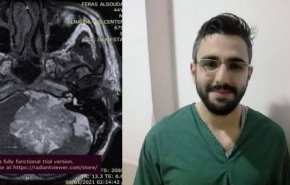 انجاز طبي لشاب سوري ينقذ حياة اربعيني