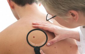 ابتكار جديد يساعد على مقاومة سرطان الجلد