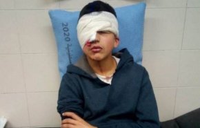 نوجوان فلسطینی به ضرب گلوله صهیونیست‌ها یک چشم خود را از دست داد+فیلم