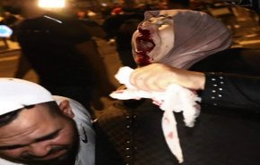 ارتفاع اصابات الفلسطينيين في القدس الى 90 اصابة