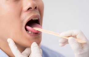 ثلاث علامات في الفم تدل على ارتفاع نسبة السكر في الدم