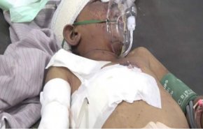 إصابة طفل بانفجار قنبلة عنقودية من مخلفات العدوان في حجة