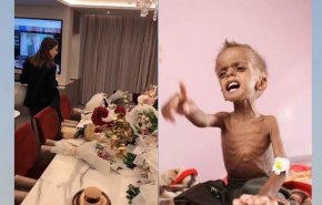 ناشطون يقارنون بين طفل يمني يموت جوعا وهدايا السعودية لنانسي!