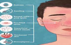 10 علامات يكشفها وجهك عن صحتك بعضها أمراض خطيرة