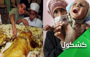 الأرقام تتحدث.. اليمنيون يعانون من الجوع والسعوديون من السمنة