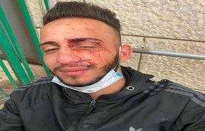 مستوطنون يعتدون على فلسطيني في القدس المحتلة