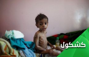 توقع إنقاذ الطفل ريان من البئر.. من ينقذ أطفال اليمن من بئر إبن سلمان وإبن زايد؟