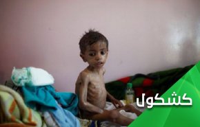 ریان مغربی از چاه نجات پیدا می کند اما کودکان یمن...