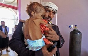 احصاءات.. كل 10 دقائق يموت طفل يمني 