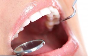أمراض يكشف عنها الفم.. 5 أعراض لا تتجاهلها 
