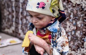 امتناع شرکت سوئدی از فروش پانسمان برای کودکان پروانه‌ای ایران
