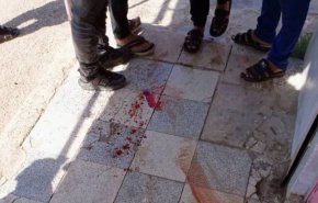 شهيدان وعشرة جرحى باعتداء المسلحين وتركيا على ريفي حلب والحسكة