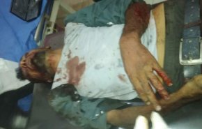 اليمن.. إصابات جراء انفجار أجسام من مخلفات العدوان