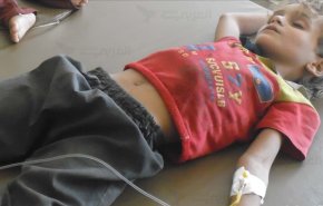 اليمن.. ألاف المرضى مهددون بتوقف إمداد الأدوية جراء العدوان والحصار 