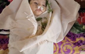 اعلامي يمني: السعودية قتلت طفلي كما قتلت الالاف من أطفال اليمن