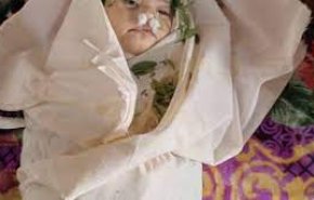 فعال رسانه‌ای یمنی: عربستان کودک مرا هم مانند هزاران کودک یمنی کشت