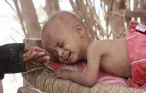 درخواست صنعاء از سازمان ملل برای نجات جان بیش از ۵ هزار بیمار در یمن