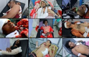 149 شهید و مجروح یمنی در حملات ائتلاف سعودی طی دو ماه گذشته