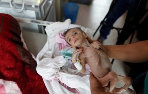 اليونيسف تحذر.. كل عشر دقائق يموت طفل يمني 