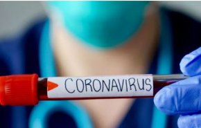 الصحة الايرانية: تسجيل 101 إصابة جديدة وحالتي وفاة بفيروس كورونا