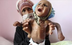 اليونيسف: 6 ملايين طفل يمني علی حافة المجاعة 