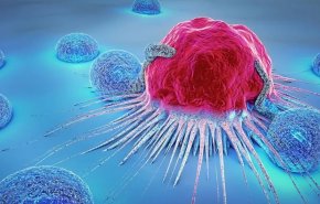 دراسة تكتشف طريقة جديدة تدمر 99% من الخلايا السرطانية!