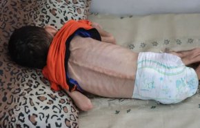 استشهاد طفل بسبب المجاعة في قطاع غزة والحصيلة ترتفع لـ40