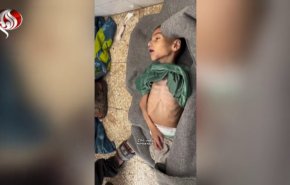استشهاد الطفل مصطفى حجازي إثر المجاعة في مستشفى شهداء الأقصى