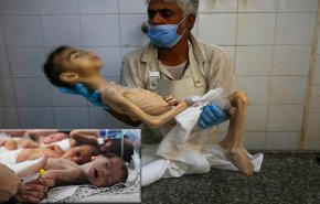 الأورومتوسطي: 26 فلسطيناً قضوا بسبب التجويع في غزة خلال 24 ساعة 