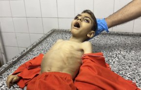 'سلاح التجويع' الصهيوني يودي بحياة طفل في غزة