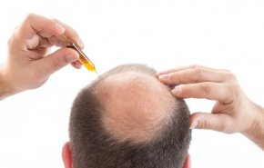 وداعًا للصلع؟ اكتشاف علمي يعيد الأمل لنمو الشعر من جديد