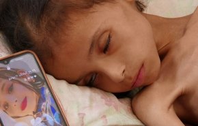 غزة.. طفلة تحتضر من الجوع: سامحيني يا ماما!..