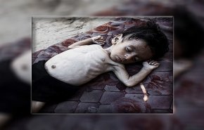 500 رضيع بمستشفيات غزة اثر حرب التجويع الإسرائيلية