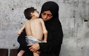  ضحايا مجاعة غزة ترتفع إلى 266 شهيدا منذ بدء الإبادة