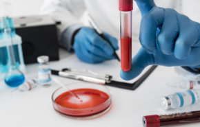 امید تازه برای مقابله با انواع سرطان تنها با یک قطره خون