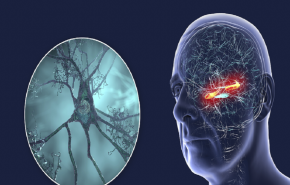 أداة جديدة تتنبأ بخطر ألزهايمر قبل سنوات من ظهور الأعراض