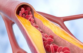 من هم الأكثر عرضة للإصابة بالسرطان؟