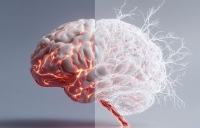 دراسة تحذر: السمنة تزيد من خطر الإصابة بالخرف