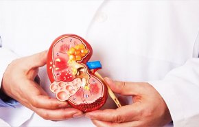 الأطعمة النباتية تقلل مخاطر الإصابة بمرض الكلى المزمن