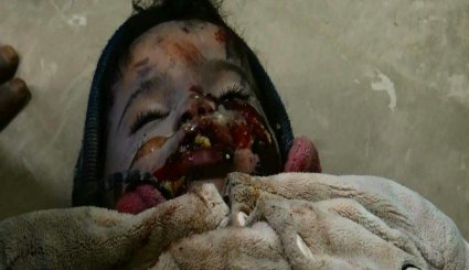 تصاویر جنایات جنگنده های آل سعود در حمله به خانه یک شهروند یمنی