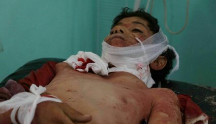 شهادت 3 کودک و زخمی شدن 18 نفر در حمله متجاوز سعودی به صعده + تصاویر