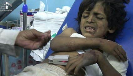 أكثر من 25 شهيدا يمنيا في حصيلة جديدة لمجزرة الجوف