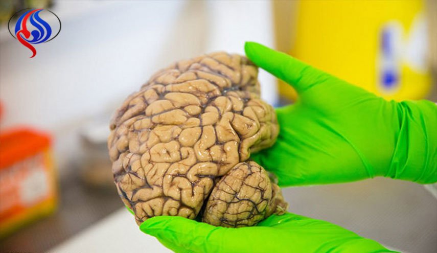 یافته جدید محققان برای کند کردن پیری مغز