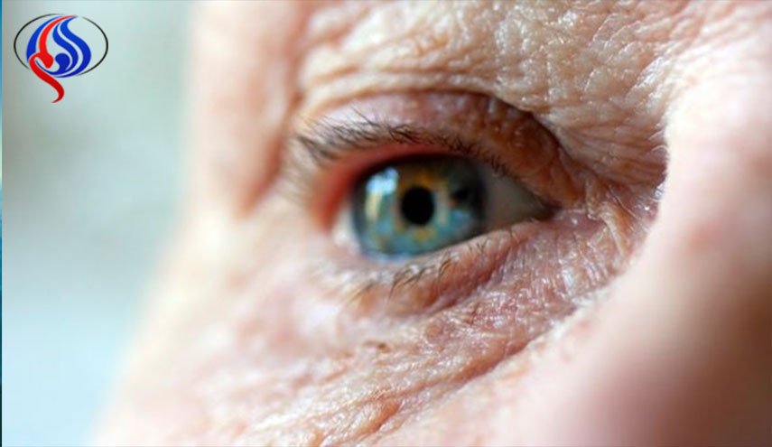 تشخیص آلزایمر 20 سال قبل ازبروز با آزمایش چشم