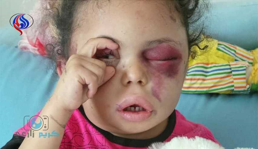 تصاویر کودکی که اعضای خانواده اش قربانی بمباران سعودی ها شدند