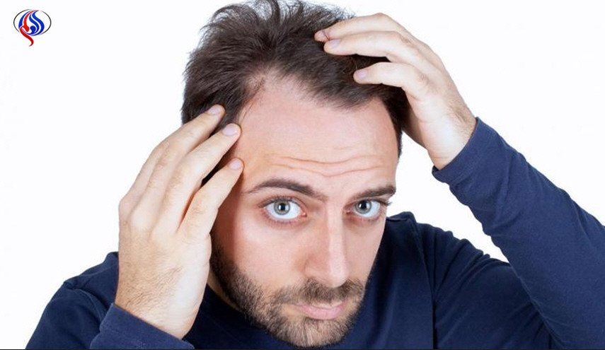 تعرف على 8 أسباب 'غير مألوفة' لتساقط الشعر