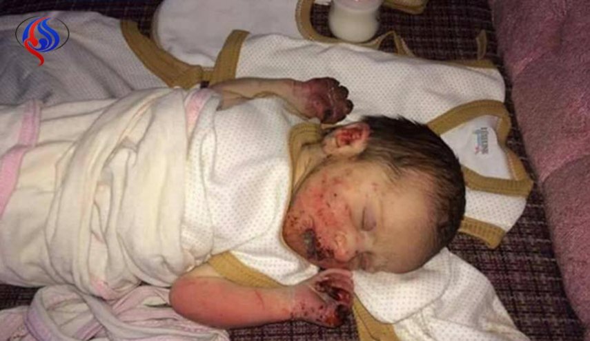 صورة.. كيف اصبحت الطفلة العراقية المعجزة بعد 70 يوما من رميها في العراء؟