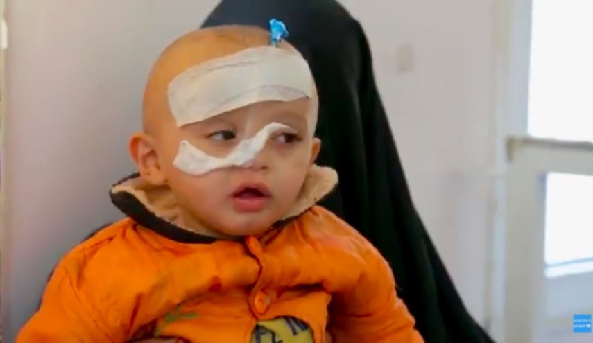 The Saudi war on Yemen is killing 130 children a day