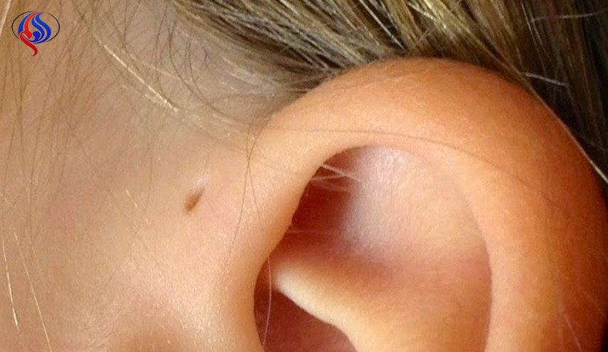 لماذا لدى البعض ثقبا صغيرا في أذنهم؟ وما دلالته؟