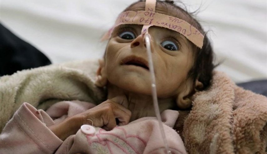 هشدار سازمان بهداشت جهانی نسبت به موج جدید «وبا» در یمن